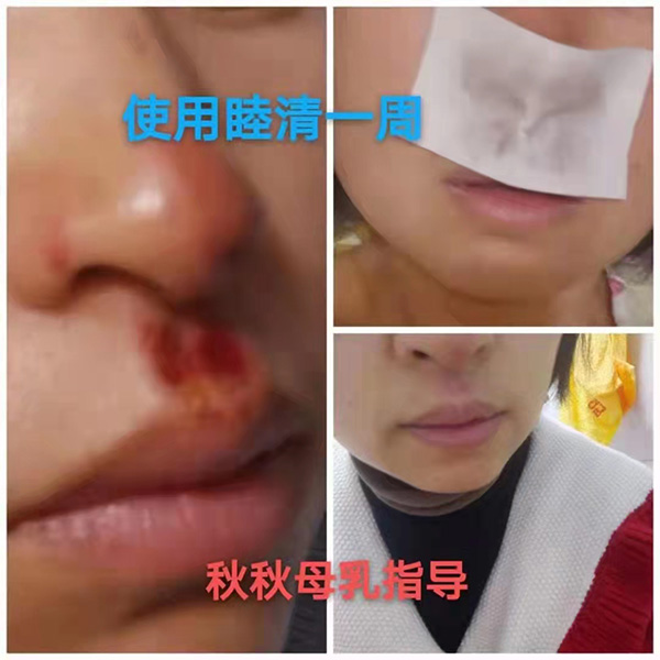 �����澏���N���Æ᣿���M�߿ڱ������������a(ch��n)ƷȦ�۟o��(sh��)